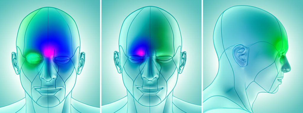 head diagram illustrating different headache locations (forehead, temples, back of head, around eyes)